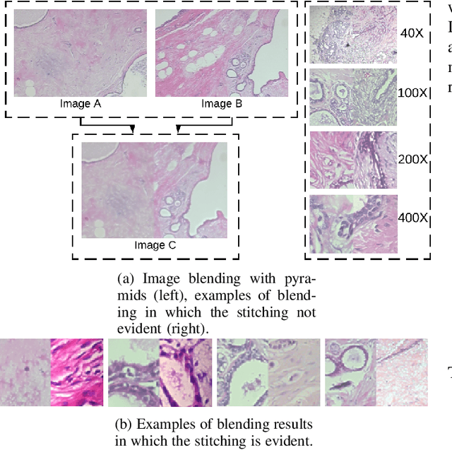 Figure 4 for Data Augmentation for Histopathological Images Based on Gaussian-Laplacian Pyramid Blending