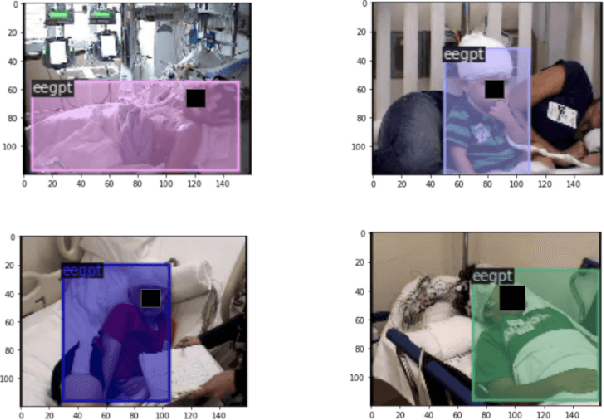 Figure 1 for Automated Detection of Patients in Hospital Video Recordings