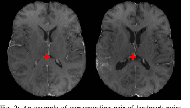 Figure 2 for The Brain Tumor Sequence Registration Challenge: Establishing Correspondence between Pre-Operative and Follow-up MRI scans of diffuse glioma patients