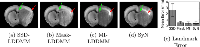 Figure 3 for A Large Deformation Diffeomorphic Approach to Registration of CLARITY Images via Mutual Information