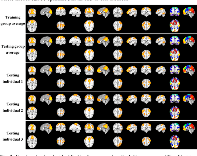 Figure 2 for Unsupervised deep learning for individualized brain functional network identification
