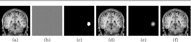 Figure 2 for A self-supervised learning strategy for postoperative brain cavity segmentation simulating resections