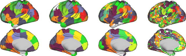 Figure 1 for Exploring Heritability of Functional Brain Networks with Inexact Graph Matching