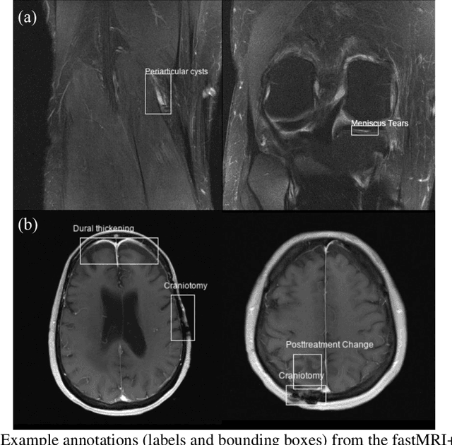 Figure 2 for fastMRI+: Clinical Pathology Annotations for Knee and Brain Fully Sampled Multi-Coil MRI Data