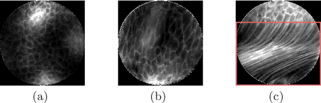 Figure 1 for Motion Artifact Detection in Confocal Laser Endomicroscopy Images
