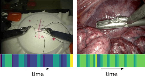 Figure 1 for Temporal Segmentation of Surgical Sub-tasks through Deep Learning with Multiple Data Sources