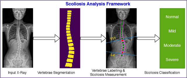 Figure 1 for Analysis of Scoliosis From Spinal X-Ray Images