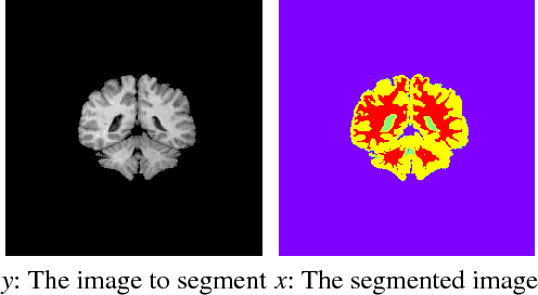 Figure 1 for Combination of Hidden Markov Random Field and Conjugate Gradient for Brain Image Segmentation