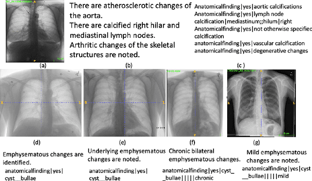 Figure 1 for Chest X-ray Report Generation through Fine-Grained Label Learning