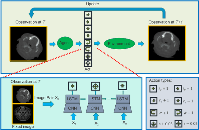 Figure 3 for Robust Multimodal Image Registration Using Deep Recurrent Reinforcement Learning