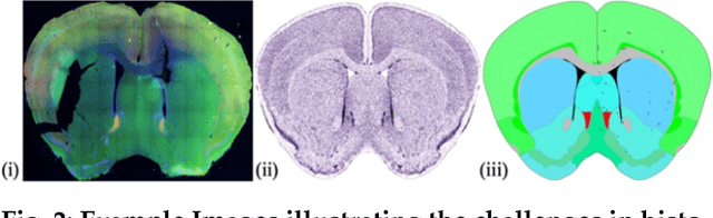 Figure 2 for Geometry Processing of Conventionally Produced Mouse Brain Slice Images