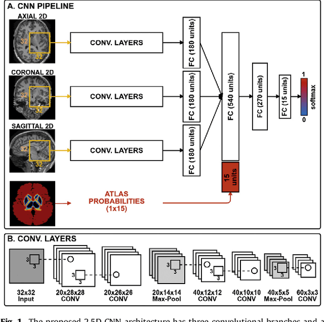 Figure 1 for Automated sub-cortical brain structure segmentation combining spatial and deep convolutional features