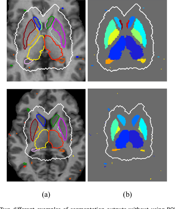 Figure 4 for Automated sub-cortical brain structure segmentation combining spatial and deep convolutional features