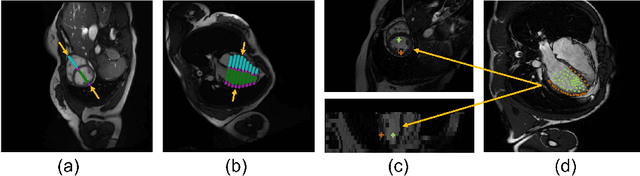 Figure 1 for TransFusion: Multi-view Divergent Fusion for Medical Image Segmentation with Transformers