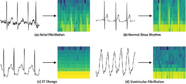 Figure 2 for ECG Arrhythmia Classification Using Transfer Learning from 2-Dimensional Deep CNN Features