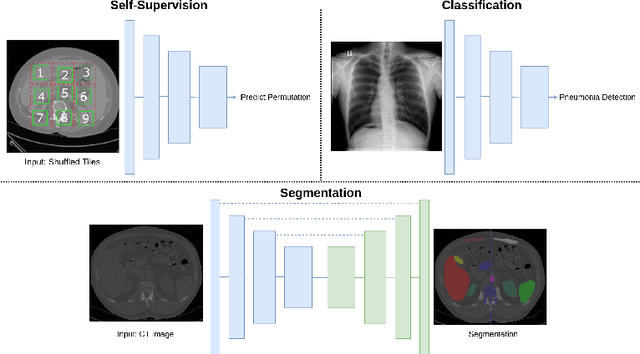 Figure 3 for Evaluating the Robustness of Self-Supervised Learning in Medical Imaging