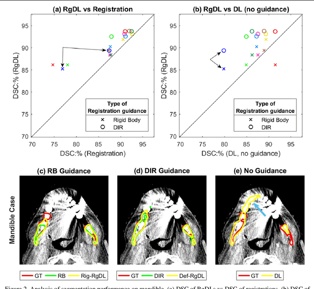 Figure 4 for Registration-Guided Deep Learning Image Segmentation for Cone Beam CT-based Online Adaptive Radiotherapy