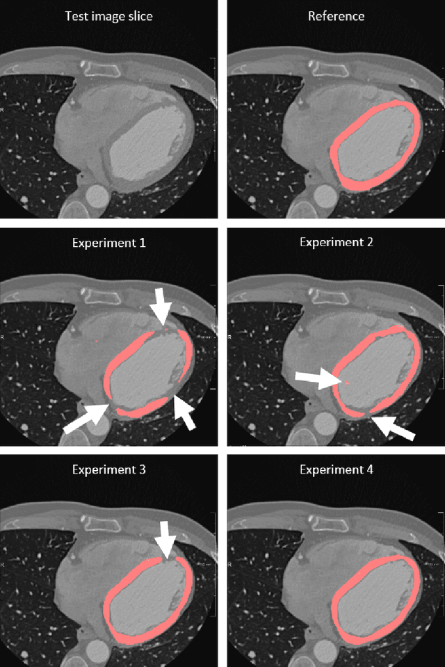 Figure 3 for Improving Myocardium Segmentation in Cardiac CT Angiography using Spectral Information