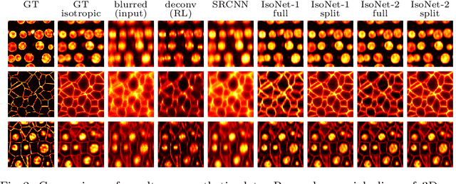 Figure 3 for Isotropic reconstruction of 3D fluorescence microscopy images using convolutional neural networks