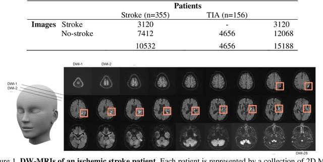 Figure 1 for Integrating uncertainty in deep neural networks for MRI based stroke analysis