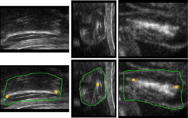 Figure 1 for Joint Segmentation and Landmark Localization of Fetal Femur in Ultrasound Volumes