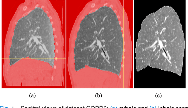 Figure 1 for Estimation of Large Motion in Lung CT by Integrating Regularized Keypoint Correspondences into Dense Deformable Registration