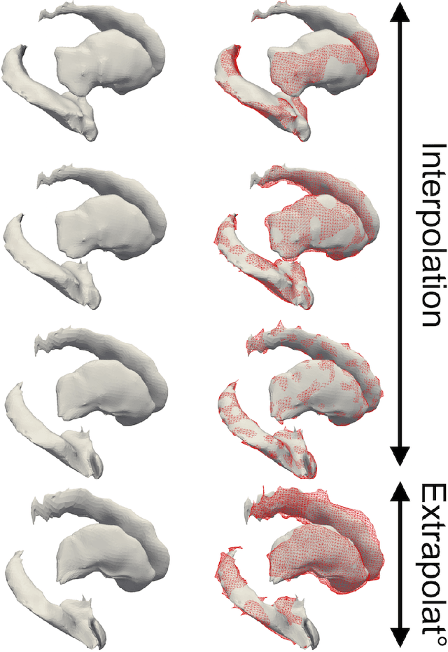 Figure 2 for Prediction of the progression of subcortical brain structures in Alzheimer's disease from baseline