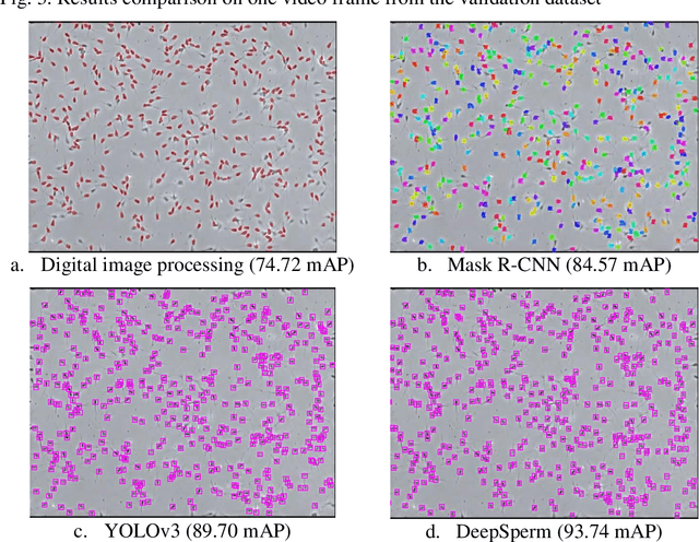 Figure 4 for DeepSperm: A robust and real-time bull sperm-cell detection in densely populated semen videos