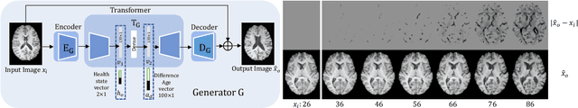 Figure 1 for Learning to synthesise the ageing brain without longitudinal data