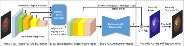 Figure 2 for DFR: Deep Feature Reconstruction for Unsupervised Anomaly Segmentation