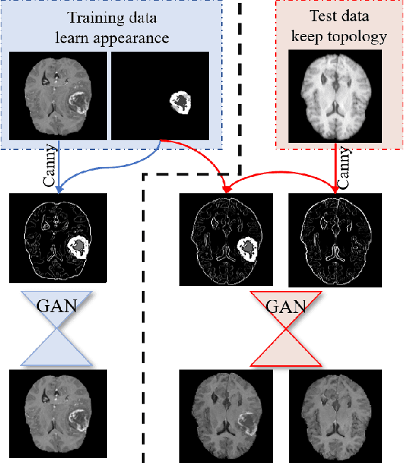 Figure 1 for Memory-efficient GAN-based Domain Translation of High Resolution 3D Medical Images