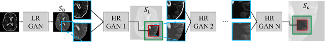 Figure 2 for Memory-efficient GAN-based Domain Translation of High Resolution 3D Medical Images
