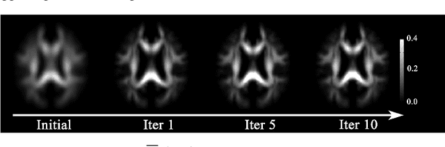 Figure 1 for Bayesian Estimation of White Matter Atlas from High Angular Resolution Diffusion Imaging