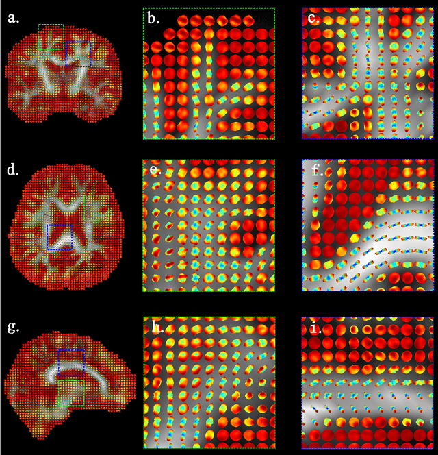 Figure 2 for Bayesian Estimation of White Matter Atlas from High Angular Resolution Diffusion Imaging