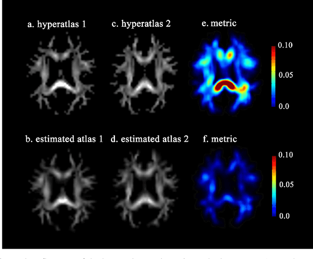 Figure 4 for Bayesian Estimation of White Matter Atlas from High Angular Resolution Diffusion Imaging