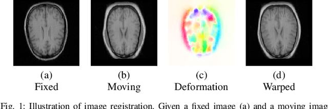 Figure 1 for Unsupervised End-to-end Learning for Deformable Medical Image Registration