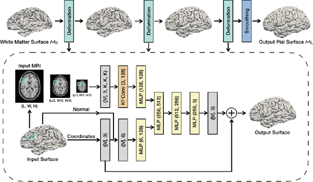 Figure 1 for PialNN: A Fast Deep Learning Framework for Cortical Pial Surface Reconstruction