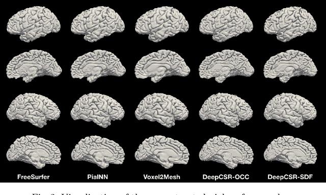 Figure 3 for PialNN: A Fast Deep Learning Framework for Cortical Pial Surface Reconstruction