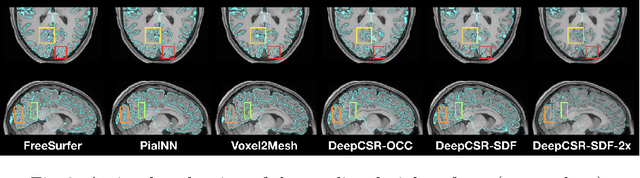 Figure 4 for PialNN: A Fast Deep Learning Framework for Cortical Pial Surface Reconstruction