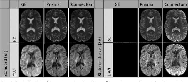 Figure 3 for Harmonization of diffusion MRI datasets with adaptive dictionary learning