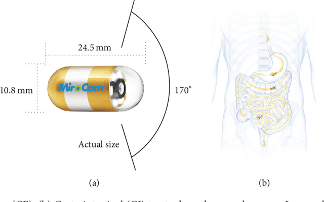 Figure 1 for Advanced Image Enhancement Method for Distant Vessels and Structures in Capsule Endoscopy