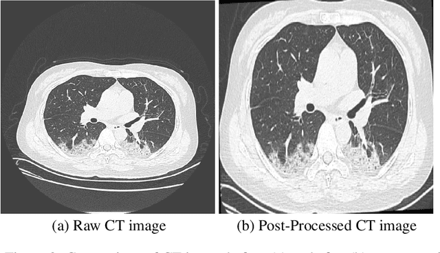 Figure 3 for COVID-Net CT-S: 3D Convolutional Neural Network Architectures for COVID-19 Severity Assessment using Chest CT Images