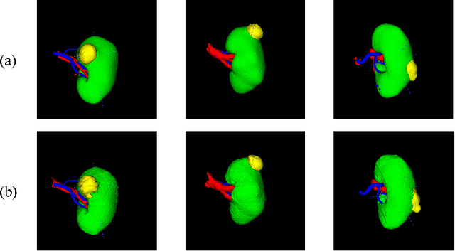 Figure 3 for KiPA22 Report: U-Net with Contour Regularization for Renal Structures Segmentation