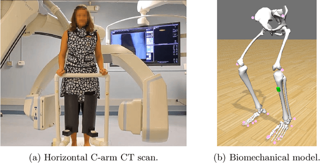 Figure 1 for Inertial Measurements for Motion Compensation in Weight-bearing Cone-beam CT of the Knee
