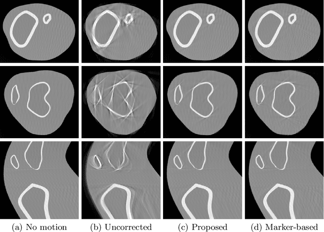Figure 3 for Inertial Measurements for Motion Compensation in Weight-bearing Cone-beam CT of the Knee
