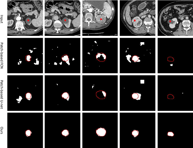 Figure 3 for Interactive Medical Image Segmentation via Point-Based Interaction and Sequential Patch Learning