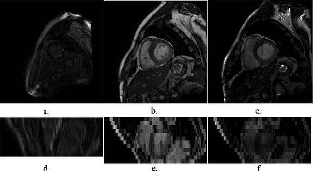 Figure 3 for An Automatic Cardiac Segmentation Framework based on Multi-sequence MR Image