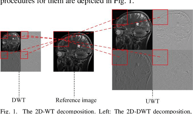 Figure 1 for Denoising Auto-encoding Priors in Undecimated Wavelet Domain for MR Image Reconstruction