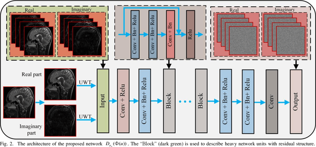 Figure 4 for Denoising Auto-encoding Priors in Undecimated Wavelet Domain for MR Image Reconstruction