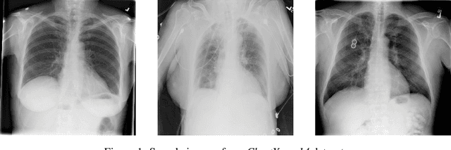 Figure 1 for Chest X-Rays Image Inpainting with Context Encoders